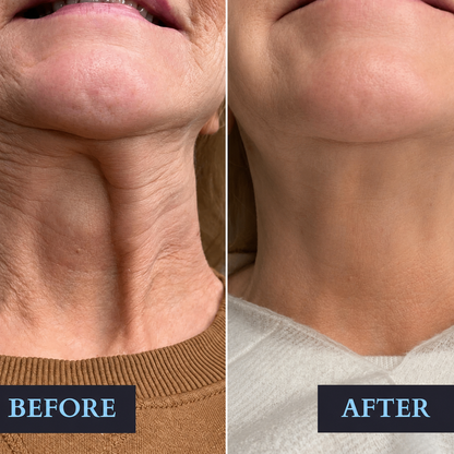 Instant Cream for Dark Circles and Wrinkles
