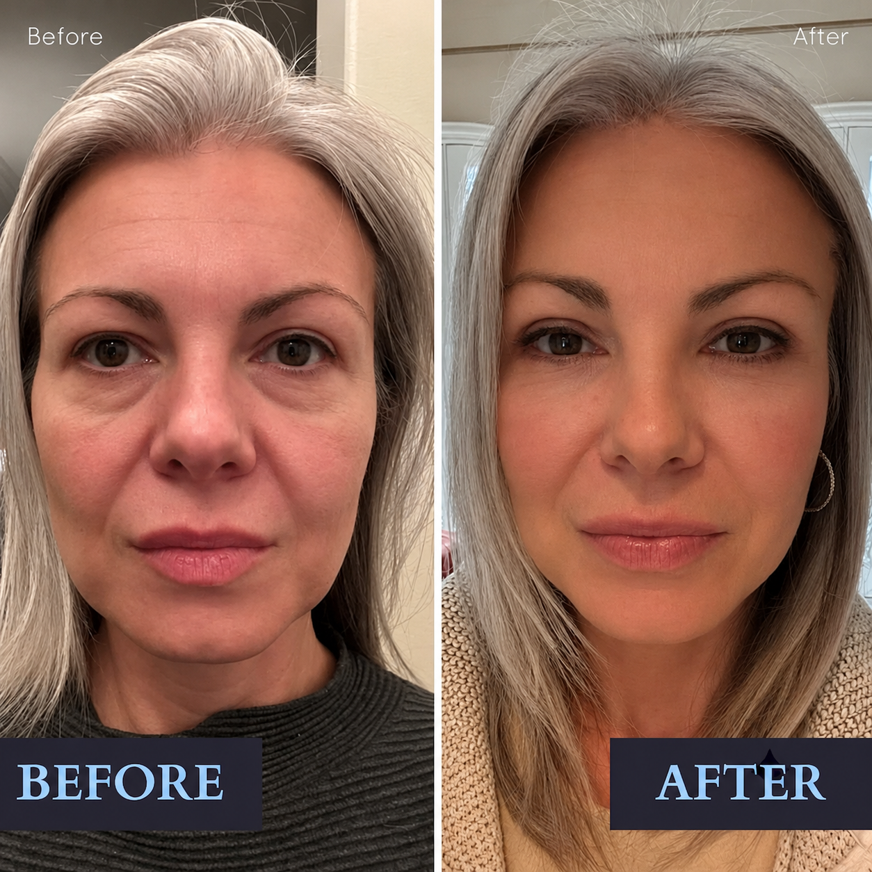 Instant Cream for Dark Circles and Wrinkles